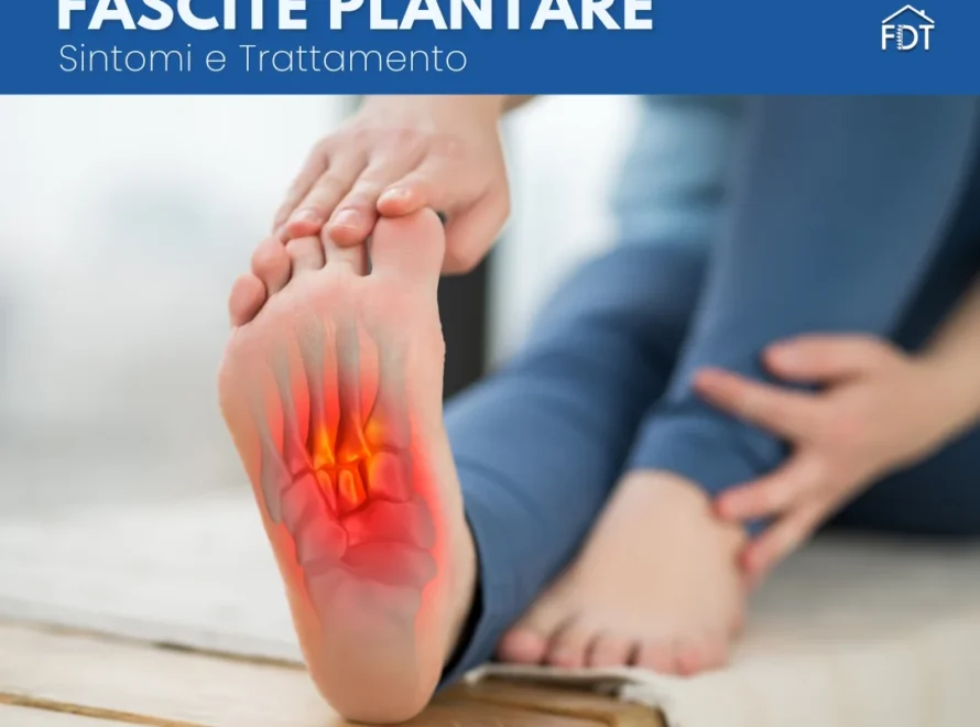 Dolore alla pianta del piede con infiammazione evidenziata in rosso per fascite plantare