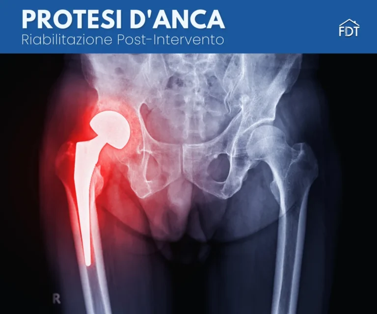 Protesi d’Anca: Guida Completa alla Riabilitazione e al Recupero Funzionale Post-Intervento