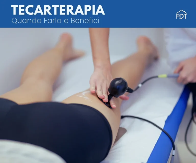 Tecarterapia in Fisioterapia: benefici, quando farla ed esercizi utili