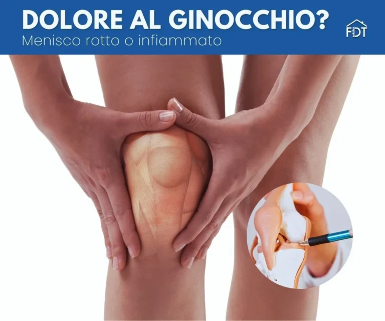 Menisco Infiammato o Rotto? Guida a Sintomi, Tempi di Recupero e Terapia Conservativa