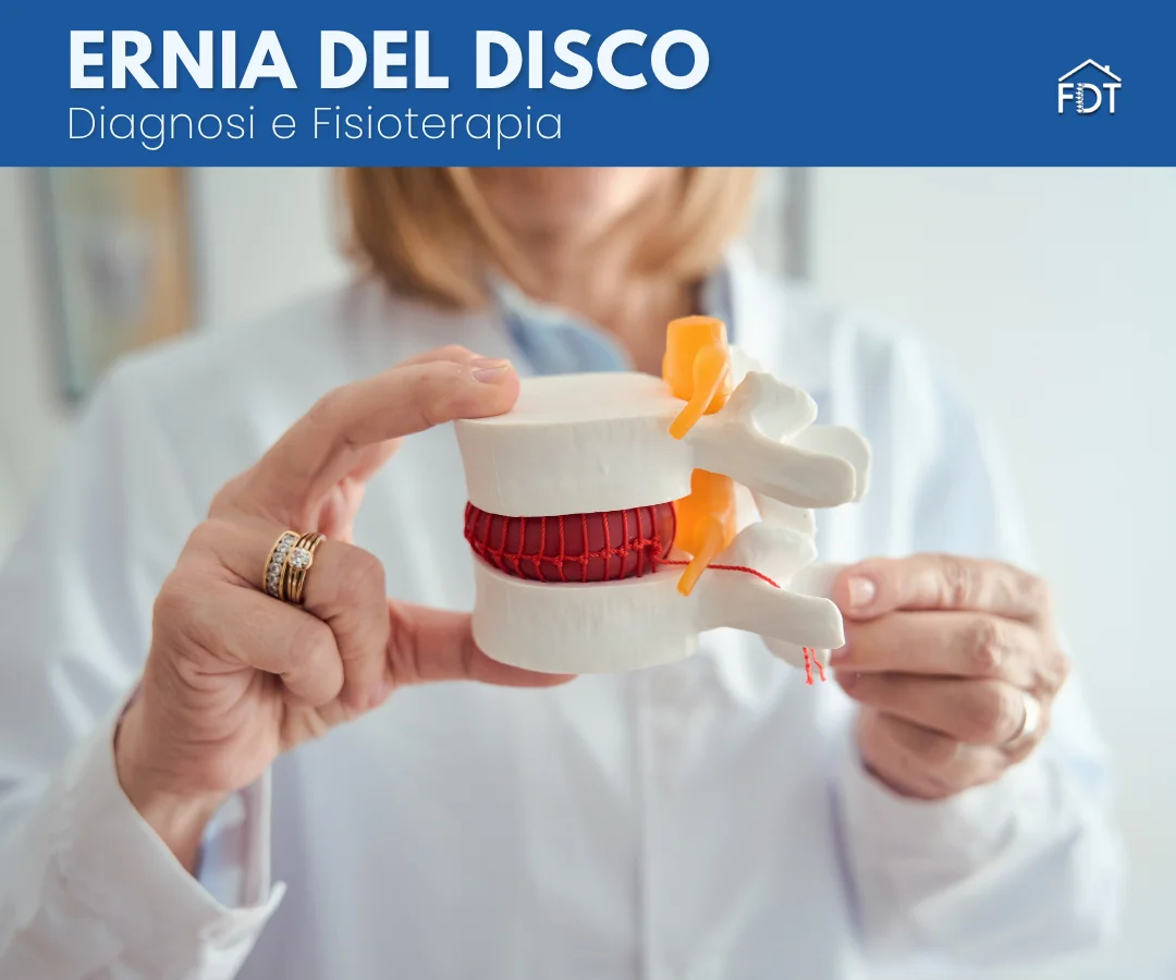 Fisioterapista mostra un modello anatomico di colonna vertebrale con ernia del disco.